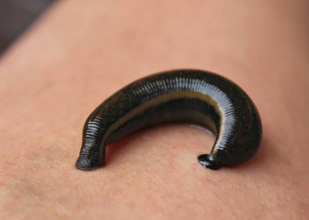 a leech on an arm