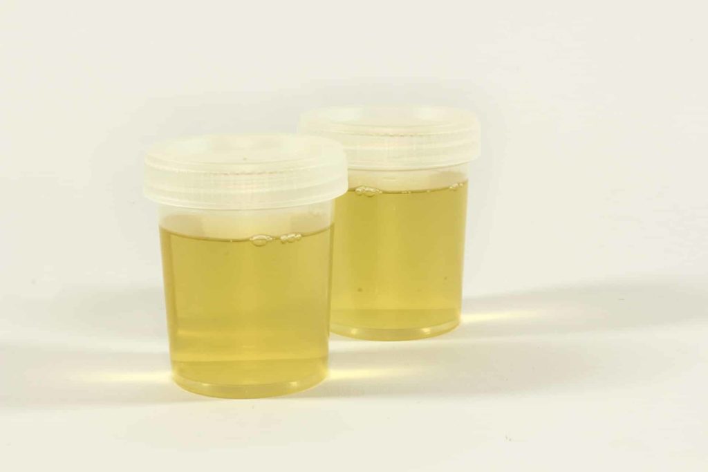 pee samples